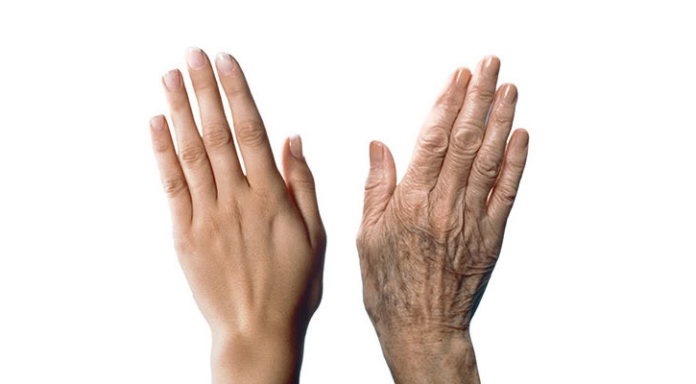 Σημάδια γήρανσης στο δέρμα σας; Υπάρχει λύση!
